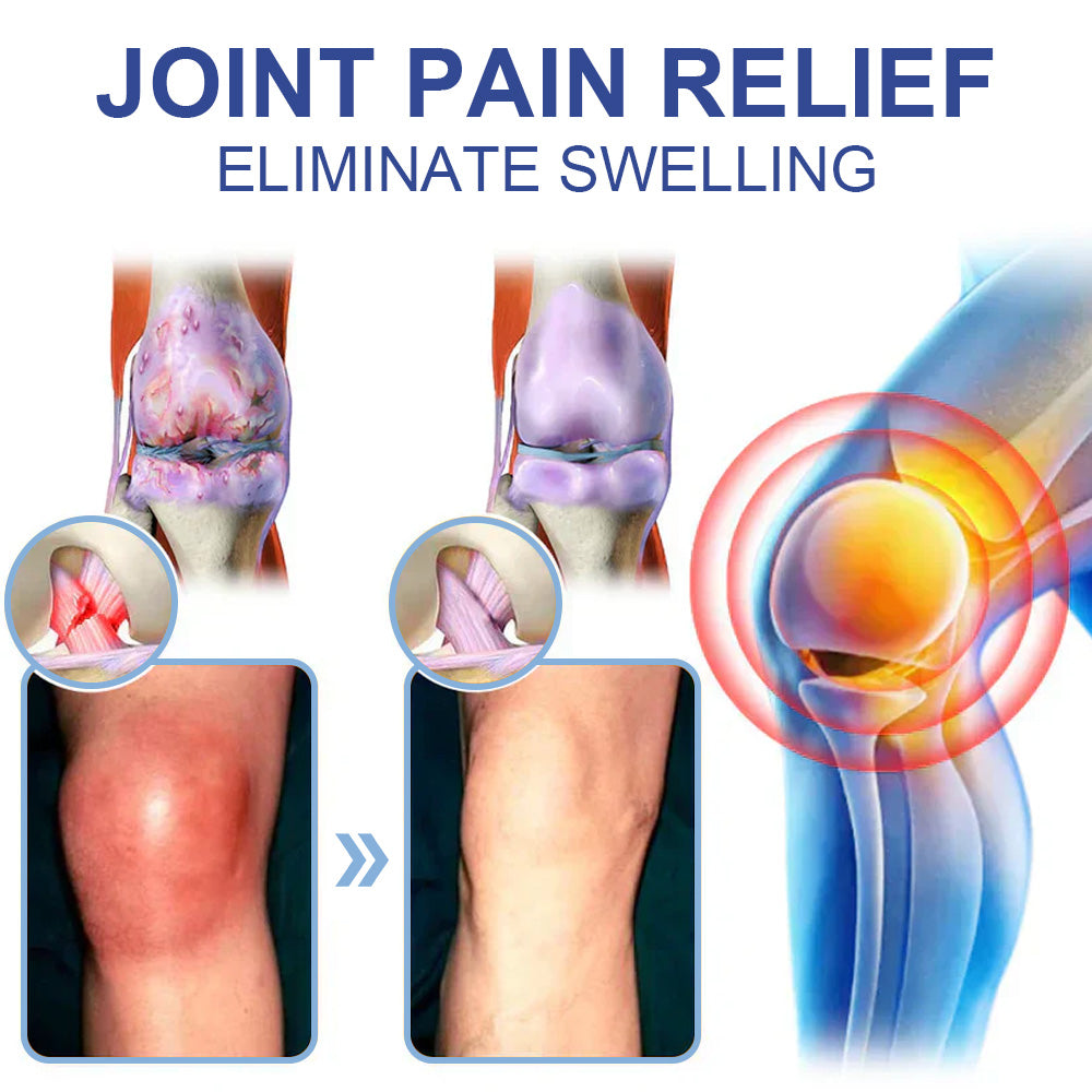 ✅Zatwierdzony przez NHS: Ourlyard® Magnesium Pain Healing Bone Cream (krem magnezowy łagodzący ból i wspomagający gojenie kości) (leczenie zapalenia stawów, neuropatii, chorób reumatycznych, skurczów mięśni, drgań i urazów sportowych)
