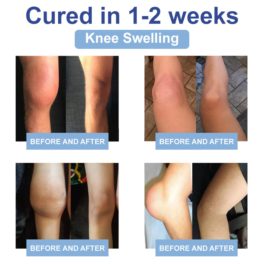 ✅Zatwierdzony przez NHS: Ourlyard® Magnesium Pain Healing Bone Cream (krem magnezowy łagodzący ból i wspomagający gojenie kości) (leczenie zapalenia stawów, neuropatii, chorób reumatycznych, skurczów mięśni, drgań i urazów sportowych)