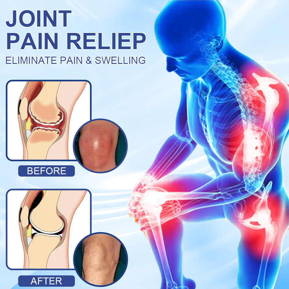 ✅Zatwierdzony przez NHS: Ourlyard® Magnesium Pain Healing Bone Cream (krem magnezowy łagodzący ból i wspomagający gojenie kości) (leczenie zapalenia stawów, neuropatii, chorób reumatycznych, skurczów mięśni, drgań i urazów sportowych)