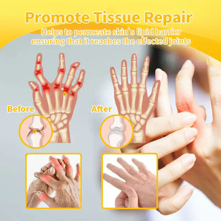 💧🐝 Ourlyard™ Magnesium Oil & Bee Venom Joint Healing Spray 👨⚕️ Zatwierdzone przez Australijskie Stowarzyszenie Ortopedyczne (AOA)