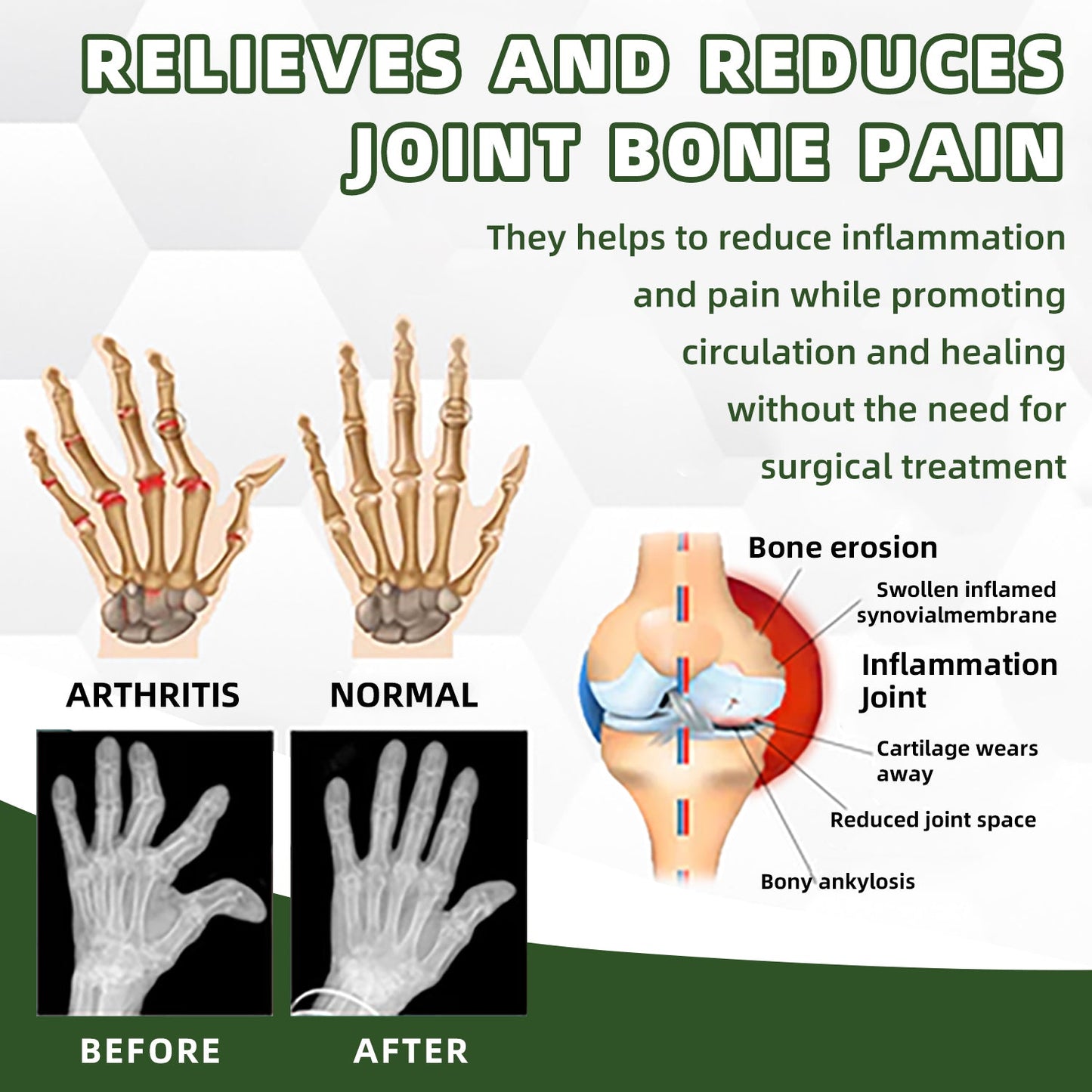 🎄🎄 Cvreoz™ Australian honey bee Venom Pain and Bone Healing Cream🎄Rabat ograniczony czasowo Ostatnie 30 minut🐝