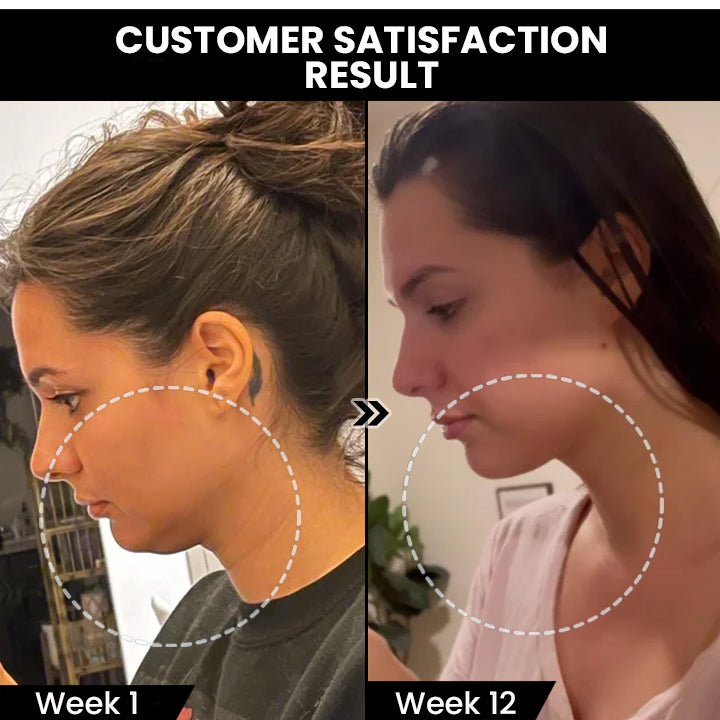 Veruniz Limfatice-Circurl Cercei magnetici de acupunctură