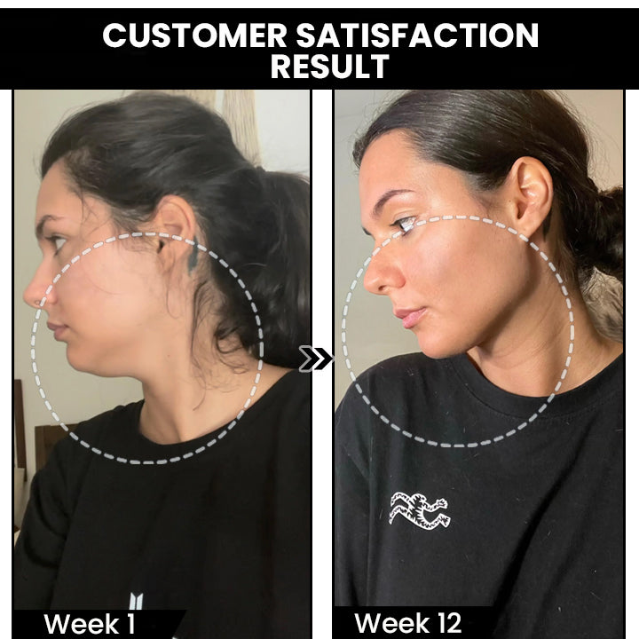 Veruniz Limfatice-Circurl Cercei magnetici de acupunctură