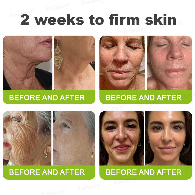 💛✅Wyprodukowane i wysyłane z USA 💫Rolimey® Botox & Vita-A Retinol Shot Krem liftingujący i ujędrniający – ostatni dzień promocji 70% RABATU