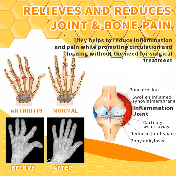 💎💎 Aeehfeng™ Jad pszczeli Joint Terapia Ulga w bólu Żel (specjalizuje się w chorobach ortopedycznych i bólu stawów)