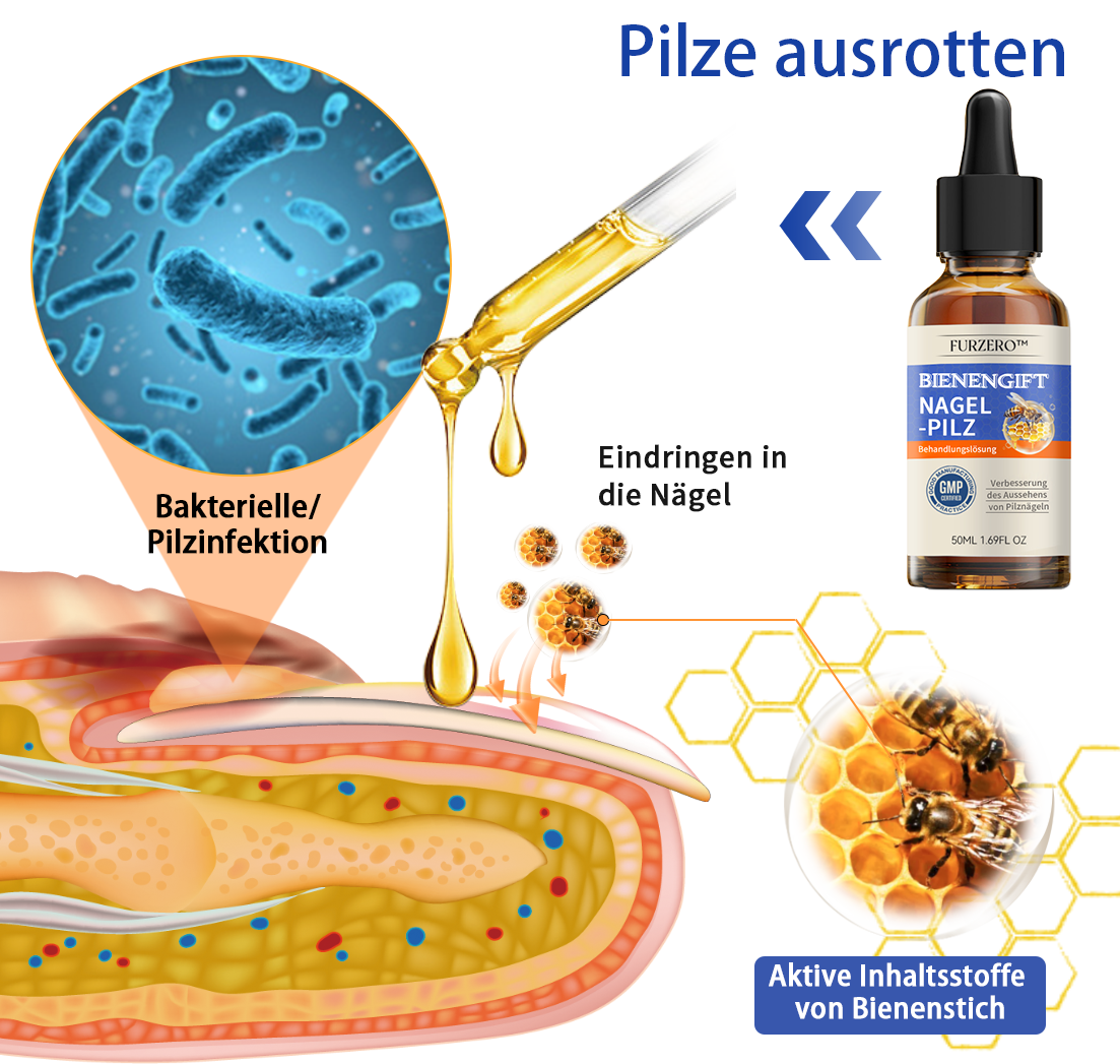 🐝🐝Furzero™ rozwiązanie na grzybicę paznokci jadem pszczelim: Całkowicie rozwiązuje problem grzybicy paznokci🌟👣