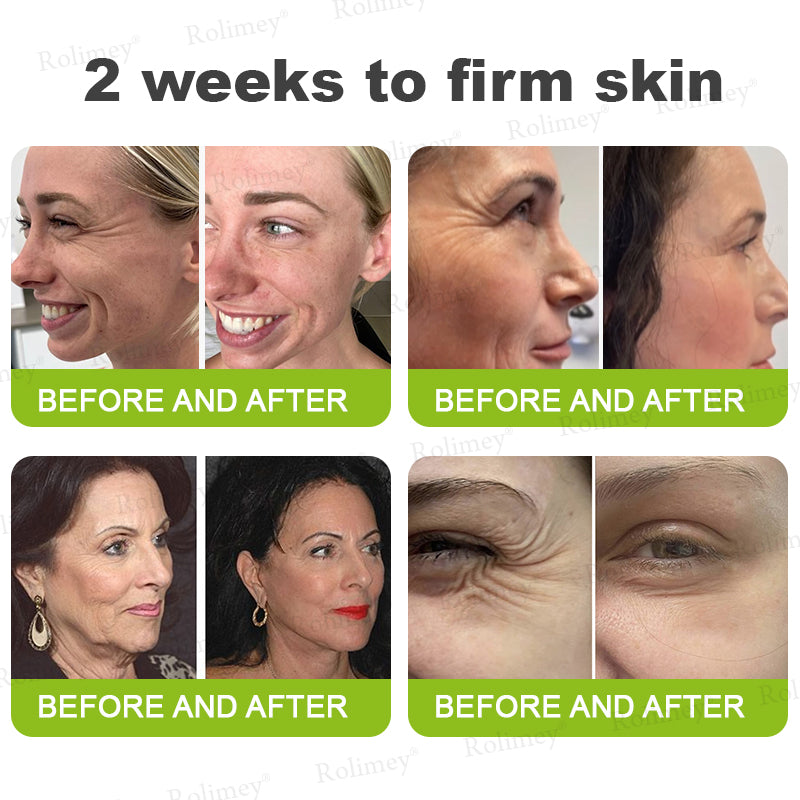 💛✅Wyprodukowane i wysyłane z USA 💫Rolimey® Botox & Vita-A Retinol Shot Krem liftingujący i ujędrniający – ostatni dzień promocji 70% RABATU