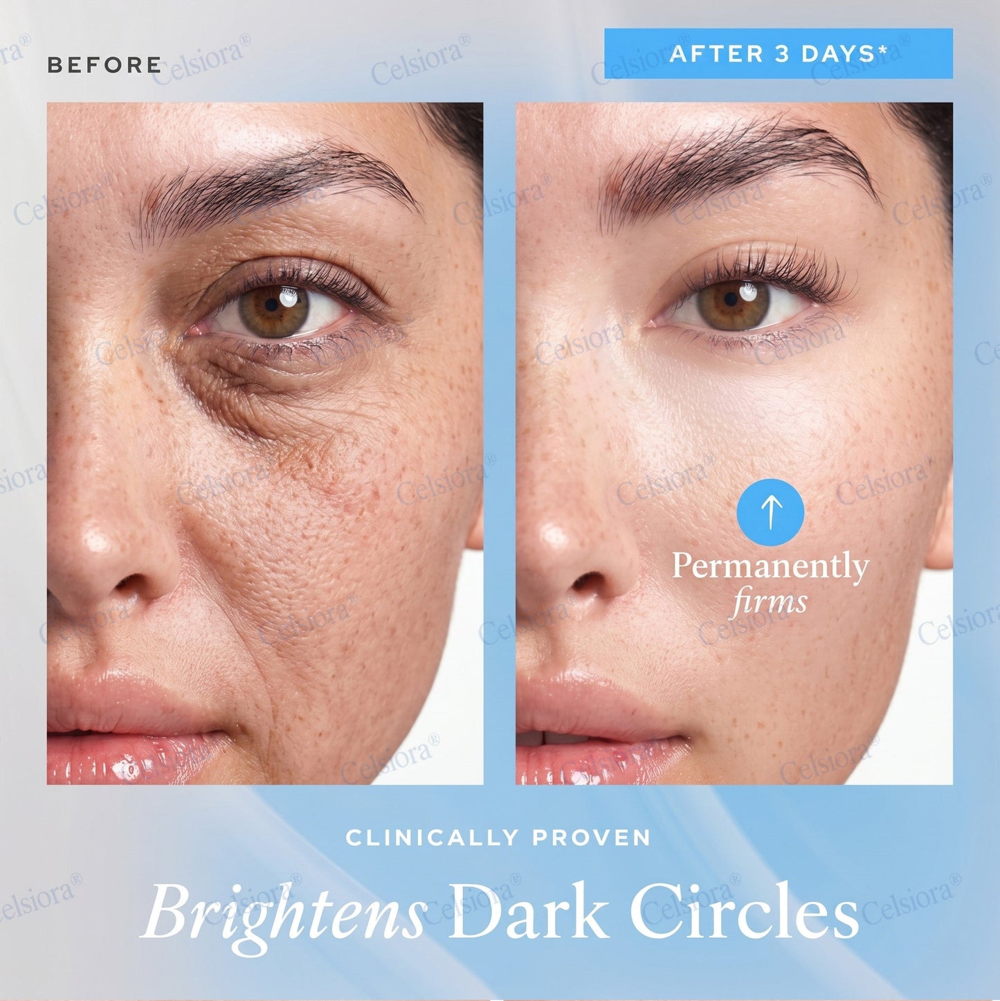 🥈📌 UK HIT SPRZEDAŻOWY Celsiora® PDRN Anti-Wrinkle Shot – Krem liftingujący i ujędrniający