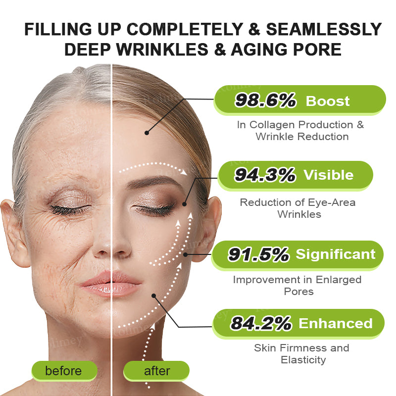 💛✅Wyprodukowane i wysyłane z USA 💫Rolimey® Botox & Vita-A Retinol Shot Krem liftingujący i ujędrniający – ostatni dzień promocji 70% RABATU