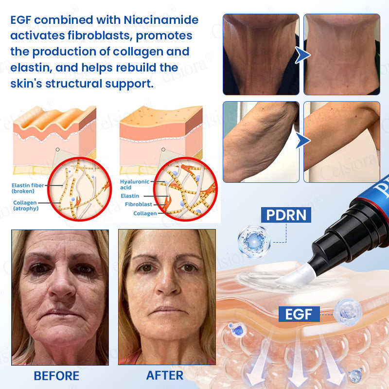 🥈📌 UK HIT SPRZEDAŻOWY Celsiora® PDRN Anti-Wrinkle Shot – Krem liftingujący i ujędrniający