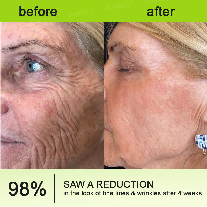 💛✅Wyprodukowane i wysyłane z USA 💫Rolimey® Botox & Vita-A Retinol Shot Krem liftingujący i ujędrniający – ostatni dzień promocji 70% RABATU