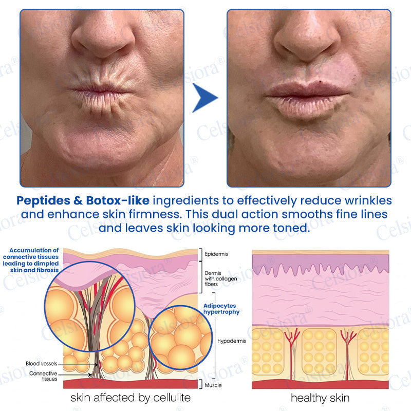 🥈📌 UK HIT SPRZEDAŻOWY Celsiora® PDRN Anti-Wrinkle Shot – Krem liftingujący i ujędrniający