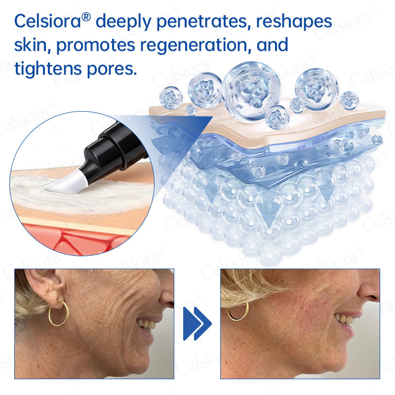 🥈📌 UK HIT SPRZEDAŻOWY Celsiora® PDRN Anti-Wrinkle Shot – Krem liftingujący i ujędrniający