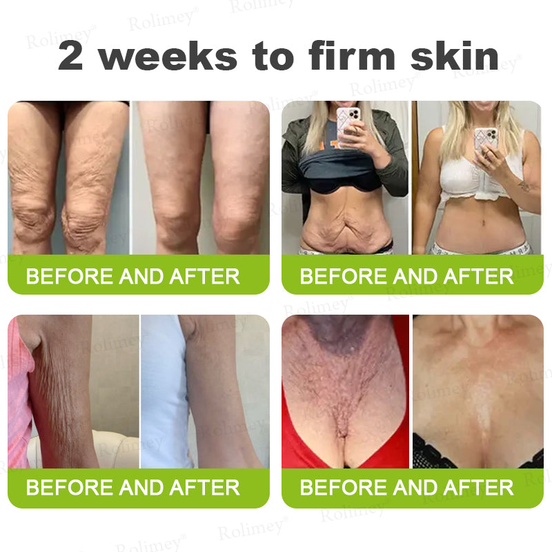 💛✅Wyprodukowane i wysyłane z USA 💫Rolimey® Botox & Vita-A Retinol Shot Krem liftingujący i ujędrniający – ostatni dzień promocji 70% RABATU