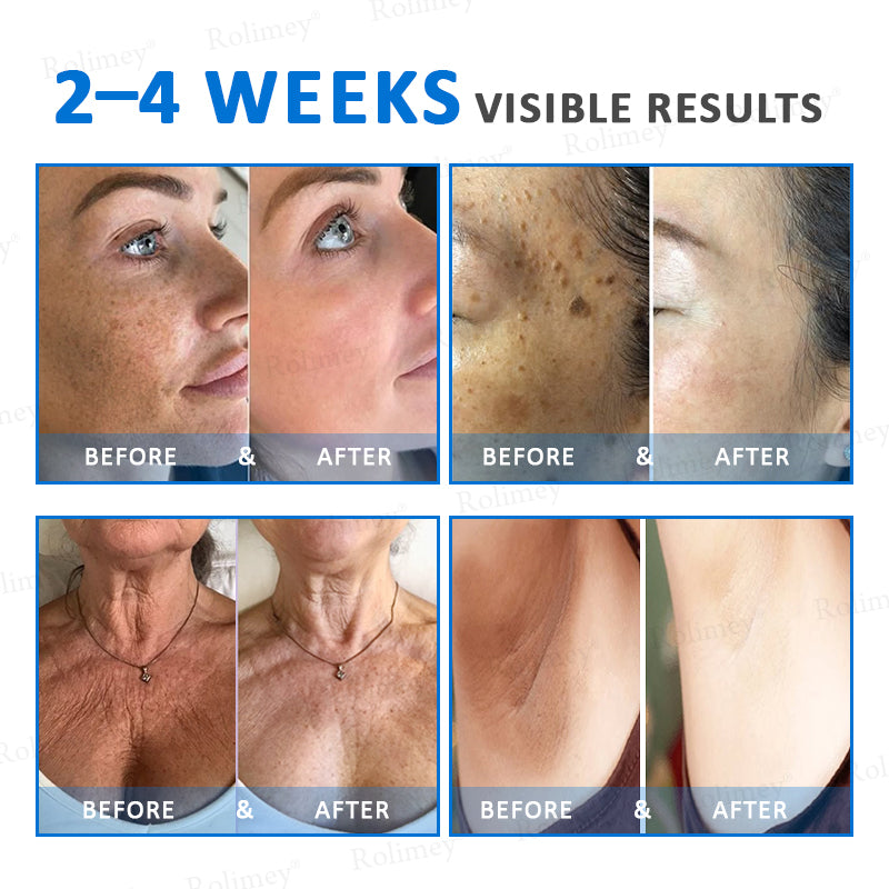 ✨✨💧(Wyprodukowane i wysyłane z Australii)✨Rolimey® Zaawansowany krem ujędrniający i redukujący zmarszczki (z filtrem SPF 50+)✨OSTATNI DZIEŃ 60% RABATU