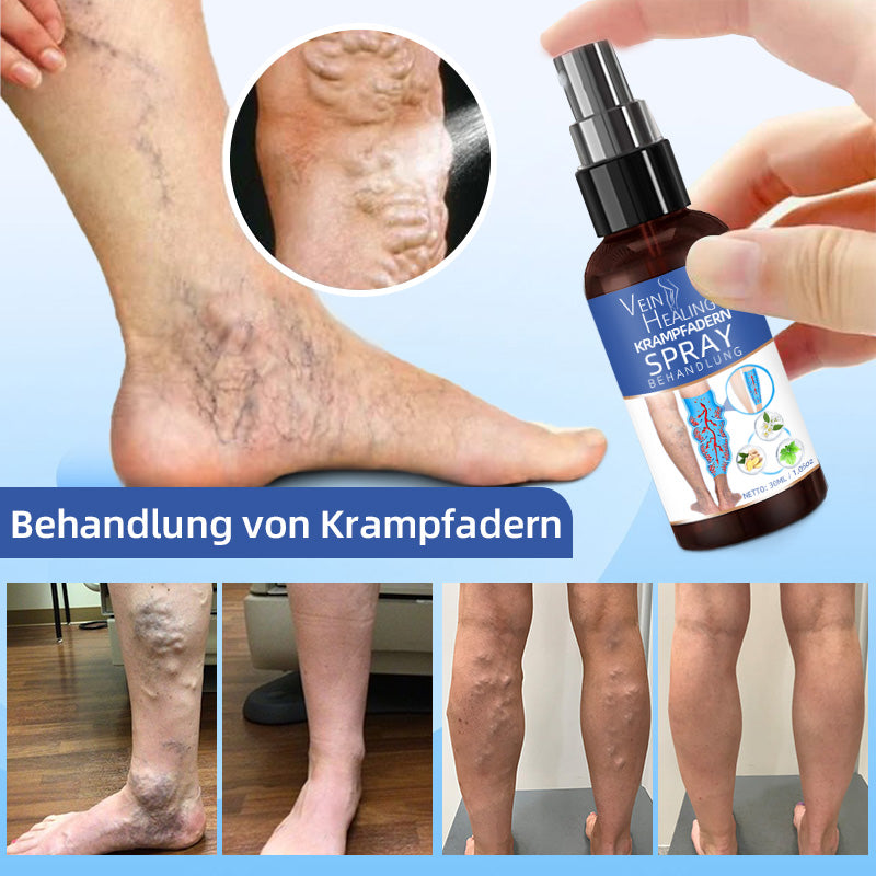 Spray do leczenia żylaków Veinhealing™🌱 (👩‍⚕️ zalecany przez kardiologów)