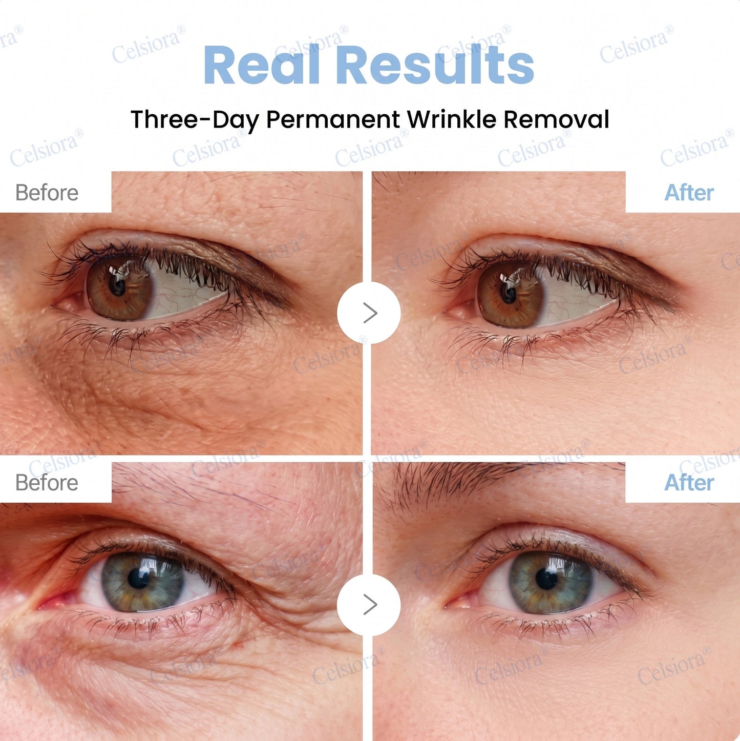 🥈📌 UK HIT SPRZEDAŻOWY Celsiora® PDRN Anti-Wrinkle Shot – Krem liftingujący i ujędrniający
