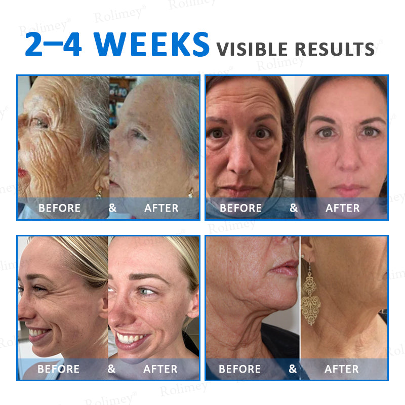✨✨💧(Wyprodukowane i wysyłane z Australii)✨Rolimey® Zaawansowany krem ujędrniający i redukujący zmarszczki (z filtrem SPF 50+)✨OSTATNI DZIEŃ 60% RABATU