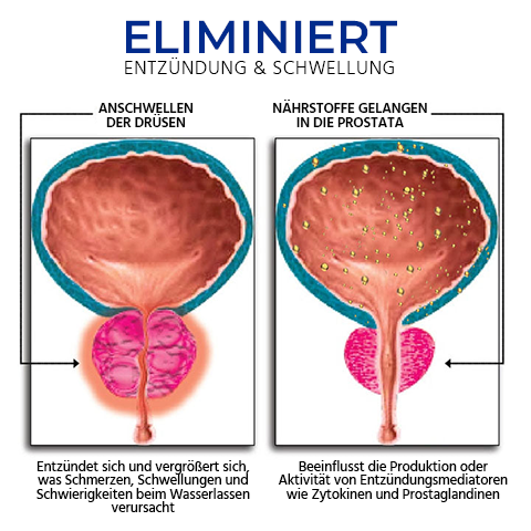 Oveallgo™ PRO BeeProsta Nasenspray für die Prostatagesundheit