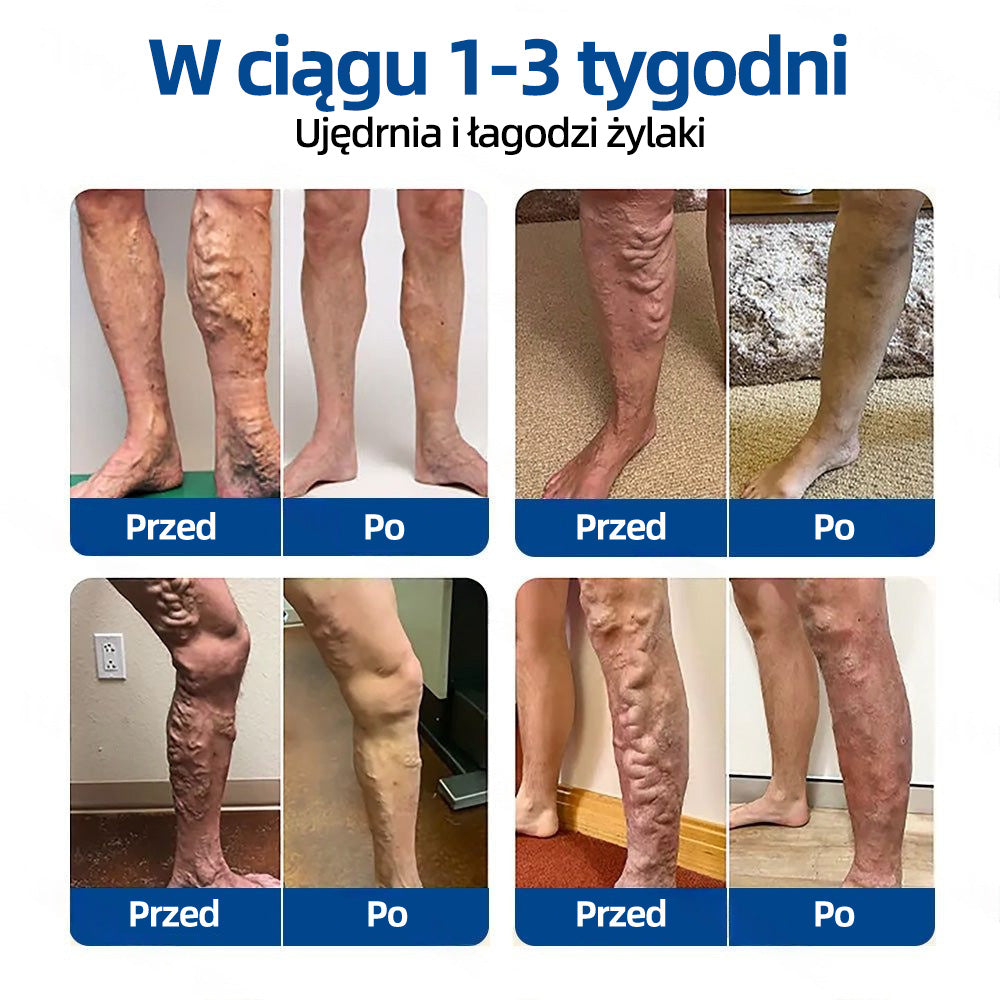 ✅ 👩‍⚕️👩‍⚕️Healrize® VeinTarget Plaster z mikroigłami ⚡ Natychmiastowa ulga, długotrwałe efekty