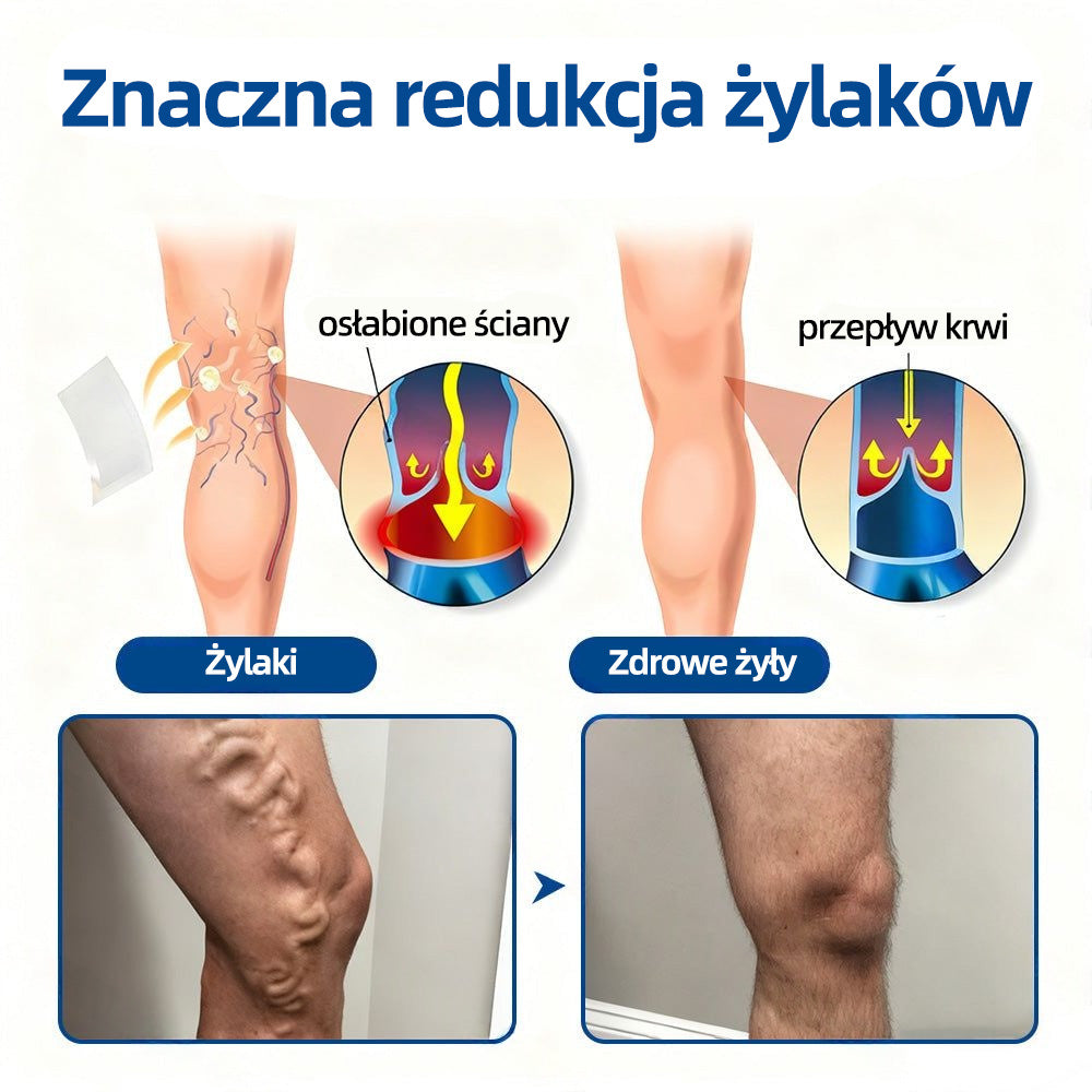 ✅ 👩‍⚕️👩‍⚕️Healrize® VeinTarget Plaster z mikroigłami ⚡ Natychmiastowa ulga, długotrwałe efekty