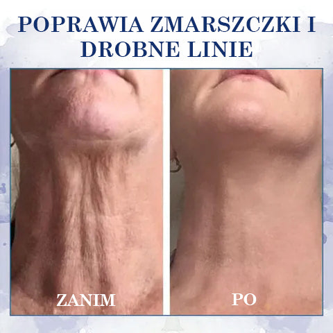 🔥 Ostatni dzień na 60% zniżki 🌸 𝐅𝐮𝐛𝐬𝐭𝐚® Zaawansowany krem ujędrniający i redukujący zmarszczki: Przywraca elastyczność skóry ⭐