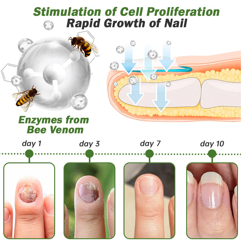 👩‍⚕️Furzero™ Nail Defense Bee Venom Treatment Serum (na wszystkie rodzaje chorób paznokci✅ dla zdrowszego wzrostu paznokci)