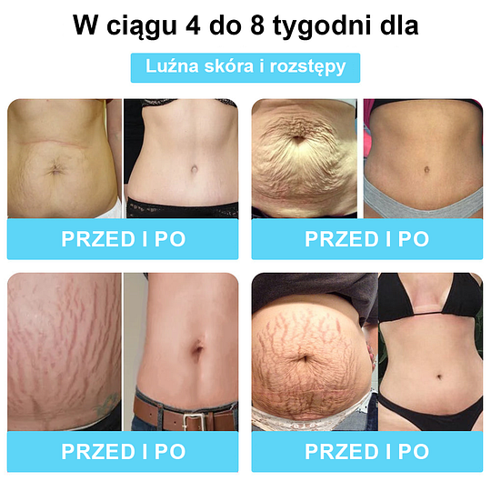 ❄️CUSIJAS™ Nano-Jonowe Odchudzające Detox Mroźne Jedwabne Majtki Korygujące🔥Ostatnie 20 minut - 70% zniżki 🔥Tylko dzisiaj