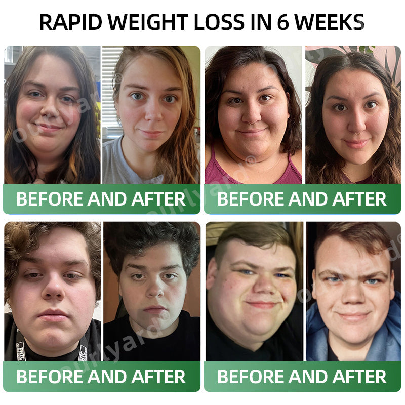 💖Ourlyard® Meglutide Diet Drops👩‍⚕️