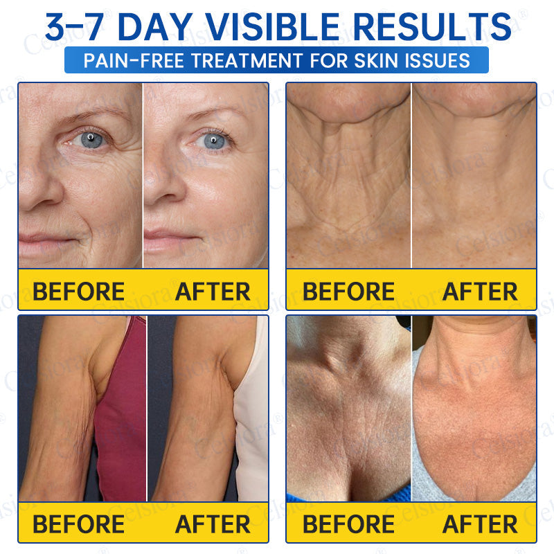 🥈📌 UK HIT SPRZEDAŻOWY Celsiora® PDRN Anti-Wrinkle Shot – Krem liftingujący i ujędrniający
