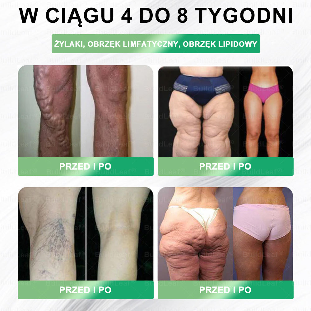 🏥Zalecenia Szpitala Uniwersyteckiego w Sofii | oficjalny sklep | 🍀𝑆𝑇𝐷𝘌𝘐® 𝐺𝐿𝑃-1 Odchudzanie Roztwór doustny -👨‍⚕️Otyłość, choroby sercowo-naczyniowe, cukrzyca, bezdech senny, problemy ze stawami i inne