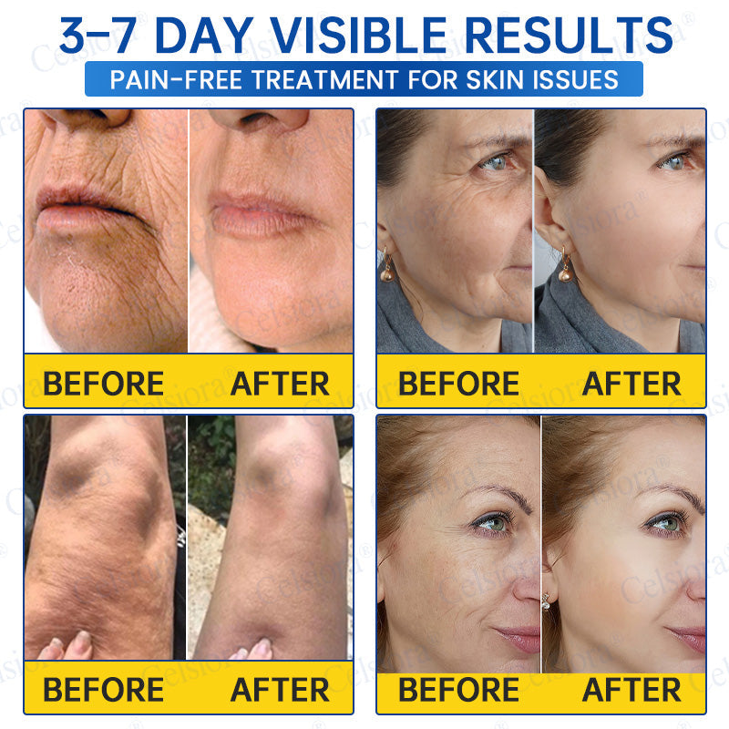 🥈📌 UK HIT SPRZEDAŻOWY Celsiora® PDRN Anti-Wrinkle Shot – Krem liftingujący i ujędrniający