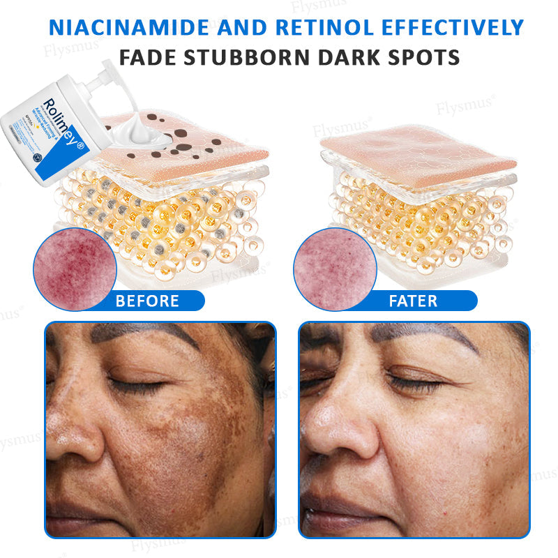 ✨✨💧(Wyprodukowane i wysyłane z Australii)✨Rolimey® Zaawansowany krem ujędrniający i redukujący zmarszczki (z filtrem SPF 50+)✨OSTATNI DZIEŃ 60% RABATU