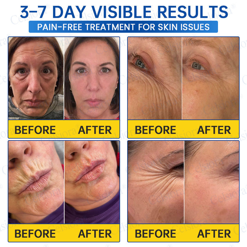 🥈📌 UK HIT SPRZEDAŻOWY Celsiora® PDRN Anti-Wrinkle Shot – Krem liftingujący i ujędrniający