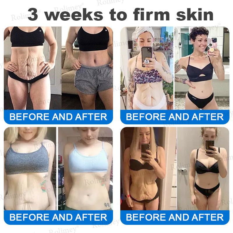✨✨💧(Wyprodukowane i wysyłane z Australii)✨Rolimey® Zaawansowany krem ujędrniający i redukujący zmarszczki (z filtrem SPF 50+)✨OSTATNI DZIEŃ 60% RABATU