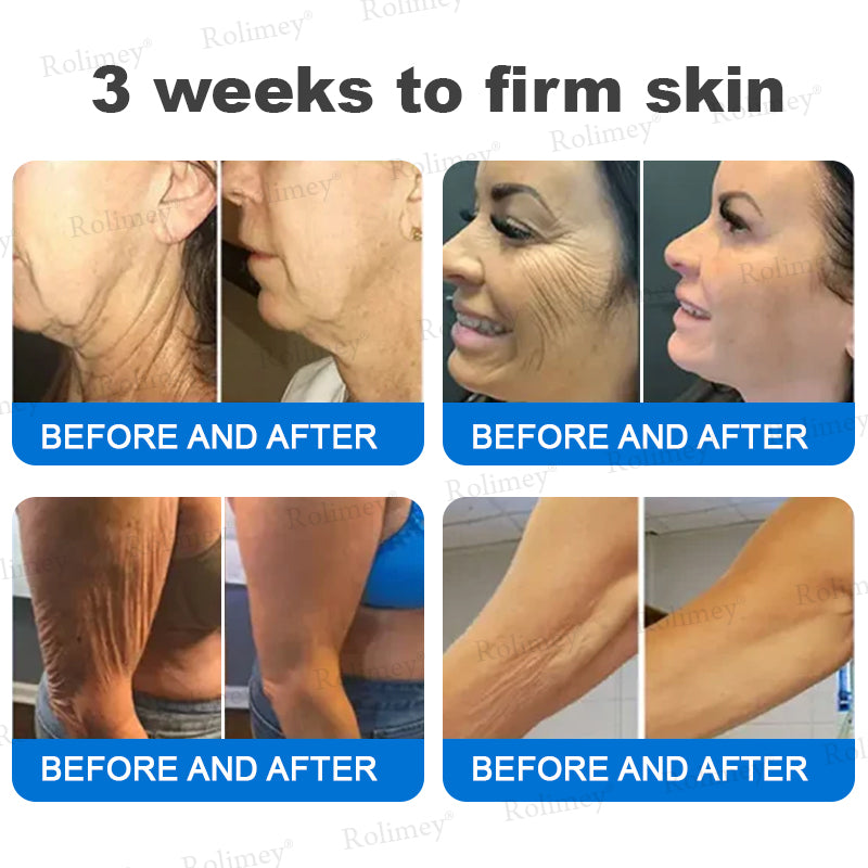 ✨✨💧(Wyprodukowane i wysyłane z Australii)✨Rolimey® Zaawansowany krem ujędrniający i redukujący zmarszczki (z filtrem SPF 50+)✨OSTATNI DZIEŃ 60% RABATU