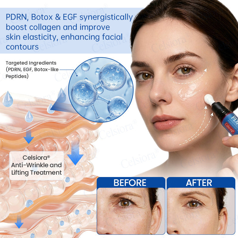 🥈📌 UK HIT SPRZEDAŻOWY Celsiora® PDRN Anti-Wrinkle Shot – Krem liftingujący i ujędrniający