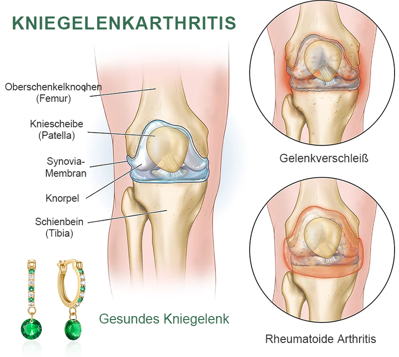 Futusly™ Turmalin Arthro- und Knochentherapie-Ohrhaken