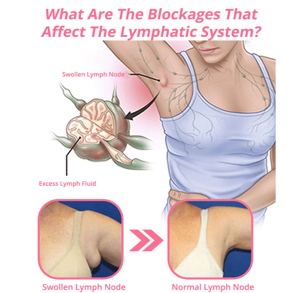 flysmus™ Kolczyki germanowe Lymphvity MagneTherapy