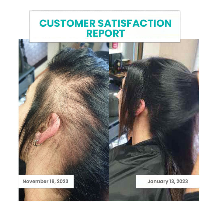 Oveallgo™ ScalpReboost Ultra NMN Hair Growth Roller