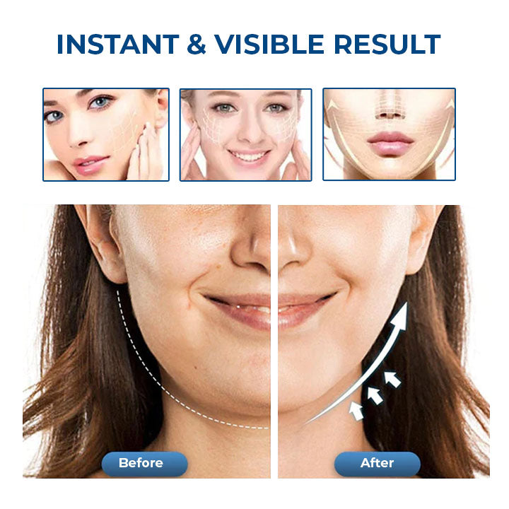 Oveallgo™ SleepBeauty Face Sculptor （Rabat ograniczony czasowo 🔥 Ostatni dzień）