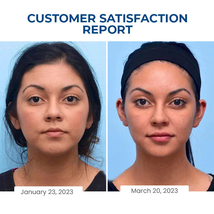 Oveallgo™ SleepBeauty Face Sculptor （Rabat ograniczony czasowo 🔥 Ostatni dzień）