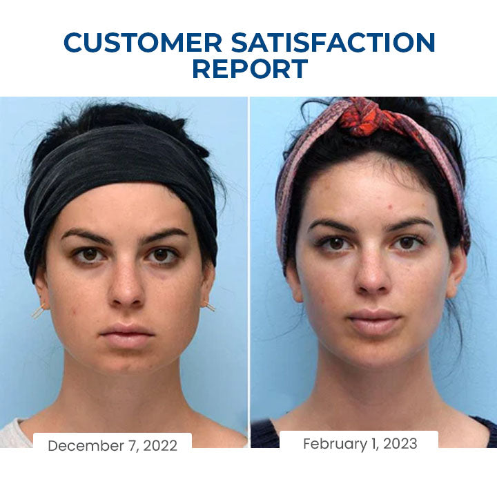 Oveallgo™ SleepBeauty Face Sculptor （Rabat ograniczony czasowo 🔥 Ostatni dzień）