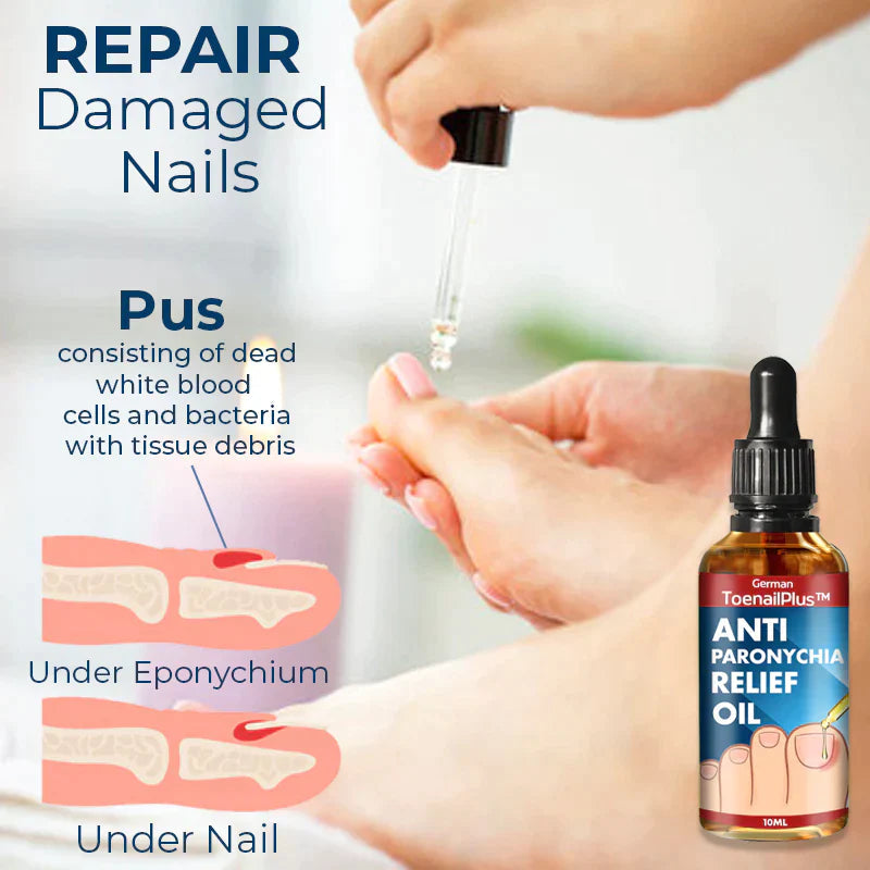 ToenailPlus™ Anti Paronichia Relief Ulei