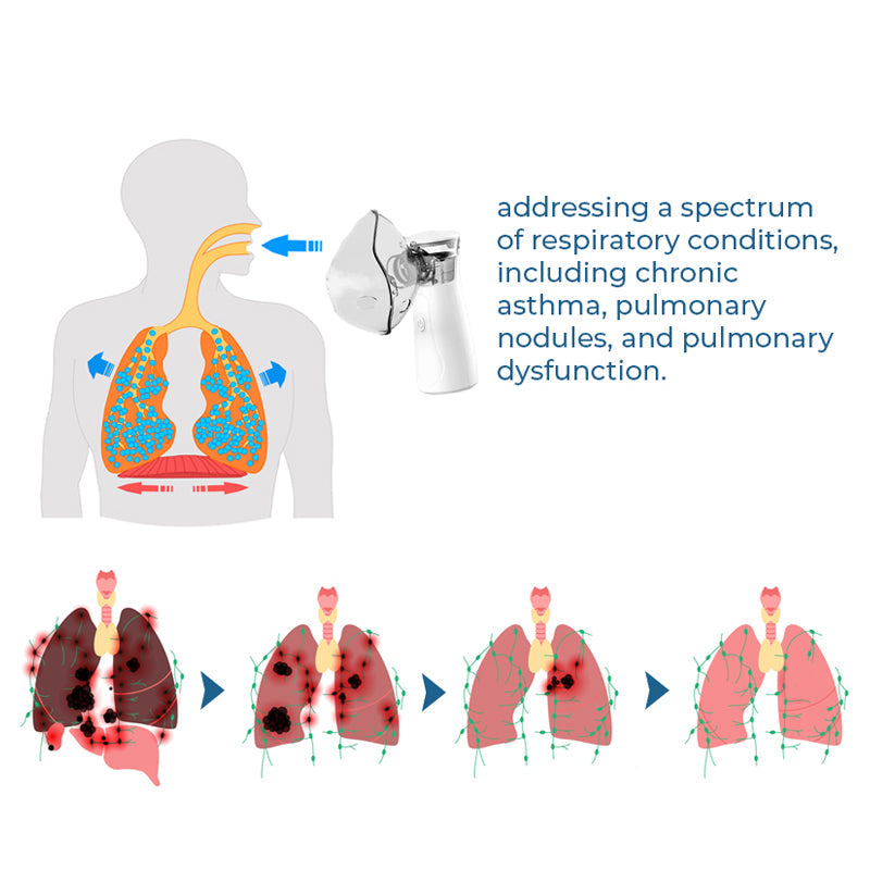 GFOUK™ Spray oczyszczający do nebulizatora LungDetox