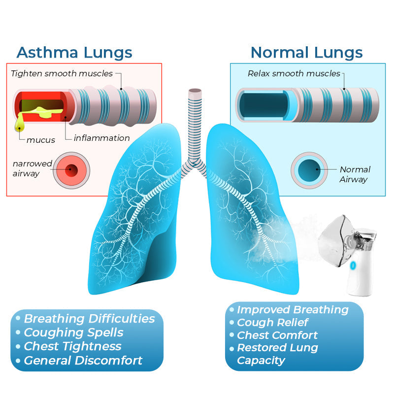 GFOUK™ Spray oczyszczający do nebulizatora LungDetox